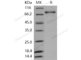 Recombinant Human PDE1B Protein (His & GST Tag)