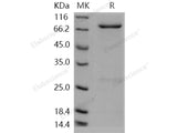 Recombinant Human PDE9A Protein (His & GST Tag)