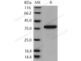 Recombinant Human PDE9A Protein (His Tag)