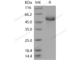 Recombinant Human HAI-1/SPINT1 Protein (His Tag)(Active)