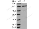 Recombinant Human SGK3/SGKL Protein (His & GST Tag)