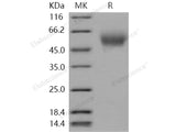 Recombinant Human CEACAM8/CD66b Protein (His Tag)(Active)