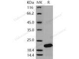 Recombinant Human SOD1/Superoxide Dismutase 1 Protein (His Tag)