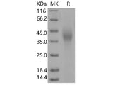 Recombinant Human SLAMF7/CD319 Protein (His Tag)(Active)