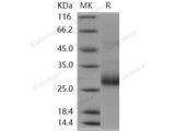 Recombinant Human RANKL/TNFSF11 Protein (Active)