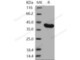 Recombinant Human USP7/HAUSP Protein (aa 208-560)