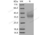 Recombinant Human DMBT1/Muclin Protein (His Tag)(Active)