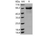 Recombinant Human IL12RB1 Protein (His Tag)(Active)