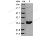 Recombinant Human UCHL1/PGP9.5 Protein (His Tag)(Active)