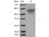 Recombinant Human TREML2/TLT2 Protein (His Tag)