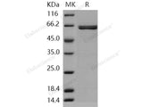 Recombinant Human AIM2 Protein (GST Tag)(Active)