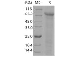 Recombinant Human Jagged 1/JAG1 Protein (His Tag)(Active)