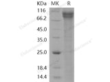 Recombinant Human Jagged 1/JAG1 Protein (Fc Tag)(Active)