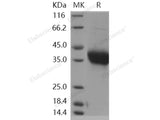 Recombinant Human ADM/Adrenomedullin Protein (Fc Tag)