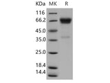 Recombinant Human OLFM4 Protein (His Tag)