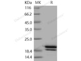 Recombinant Human REG1B/PSPS2 Protein (His Tag)