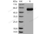 Recombinant Human DLL1/Delta-1 Protein (His Tag)(Active)