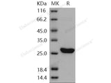 Recombinant Human UCHL3/UCH-L3 Protein (His Tag)(Active)