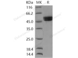 Recombinant Human AGER/RAGE Protein (His Tag)(Active)