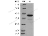 Recombinant Human PCBP1 Protein (His Tag)