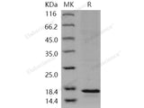 Recombinant Human LTC4S/LTC4 synthase Protein (His Tag)