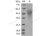 Recombinant Human CD200R1L/CD200R2/CD200RLa Protein (His Tag)