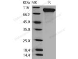 Recombinant Human Neuroligin 1/NLGN1 Protein (His Tag)