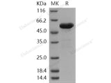 Recombinant Human ALDH7A1/ATQ1 Protein (His Tag)