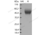 Recombinant Human CD111/Nectin-1 Protein (His Tag)(Active)