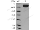 Recombinant Human CD111/Nectin-1 Protein (Fc Tag)(Active)