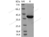 Recombinant Human Neuregulin-1/NRG1-β1 Protein (EGF Domain, Fc Tag)(Active)