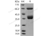 Recombinant Human CD136/MST1R Protein (His Tag)