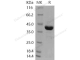 Recombinant Human AKR1A1 Protein (His Tag)