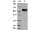 Recombinant Human GBA3/CBGL1 Protein (His Tag)(Active)