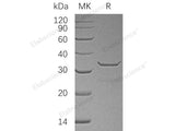 Recombinant Human SULT1B1 Protein (His Tag)(Active)