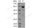 Recombinant Human DCAMKL1 Protein