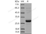 Recombinant Human SNAP25/SUP Protein (His Tag)