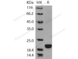 Recombinant Human LCN1/VEGP/Lipocalin-1 Protein (His Tag)