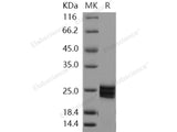 Recombinant Human ESM1/Endocan Protein (His Tag)(Active)