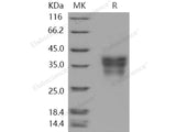 Recombinant Human EDAR/DL Protein (His Tag)