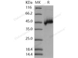 Recombinant Human NETO1/BTCL1 Protein (His Tag)