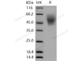 Recombinant Human ICOS Ligand/ICOSL Protein (His Tag)(Active)