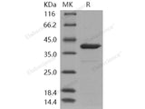 Recombinant Human Arginase-1/ARG1 Protein (HEK293 Cells, His Tag)(Active)