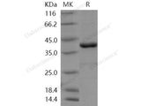 Recombinant Human PTPN12 Protein (Active)