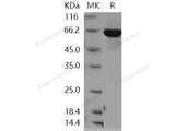 Recombinant Human PTPN12 Protein (aa 1-355, His & GST Tag)(Active)