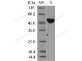 Recombinant Human VRK1 Protein