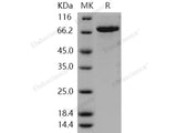 Recombinant Human CDC42BPB Protein (His & GST Tag)