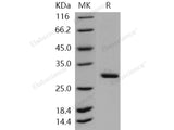 Recombinant Human METTL1 Protein (His Tag)