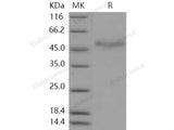 Recombinant Human Coagulation Factor VII/F7 Protein (His Tag)