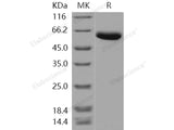 Recombinant Human Carboxypeptidase B2/CPB2 Protein (His Tag)